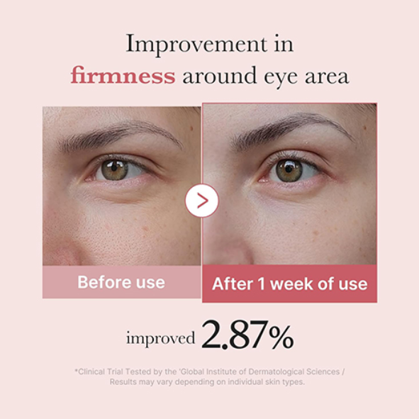 MEDICUBE - PDRN Pink Eye Serum 30ml