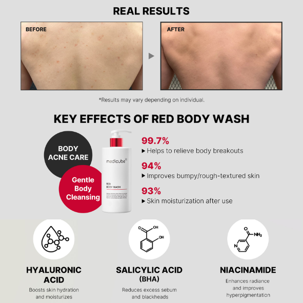 MEDICUBE - Red Acne Body Wash 2.0 400g