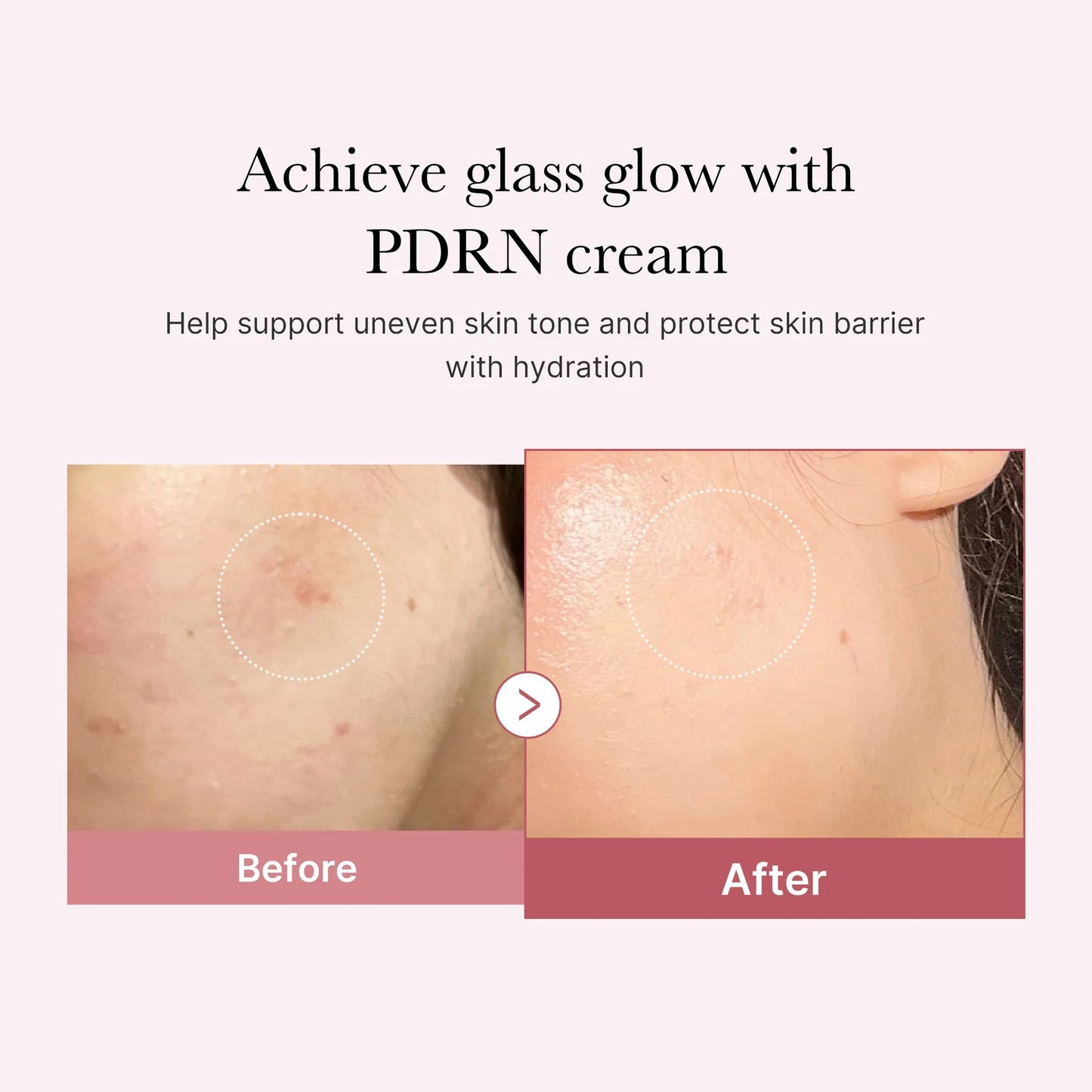 Medicube - PDRN Pink Hyaluronic Moisturizing Cream 50ml
