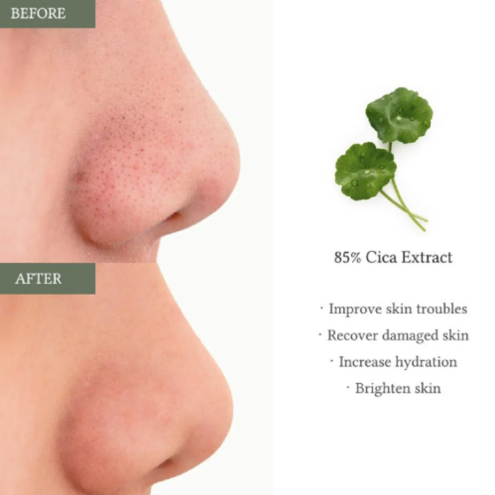 Dr. Althea - 2% Salicylic Acid Clear Pad
