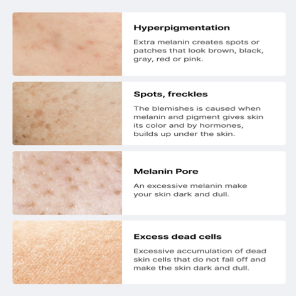 celimax - Pore+Dark Spot Brightening Pad (40pads)