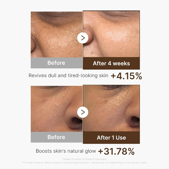 MEDICUBE - Deep Vita C Capsule Serum 30ml