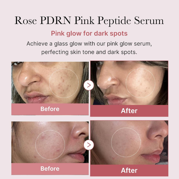 Medicube - Collagen PDRN Pink Peptide Serum 30ml