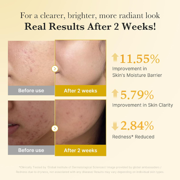 MEDICUBE - Kojic Acid Turmeric Niacinamide Serum 30ml