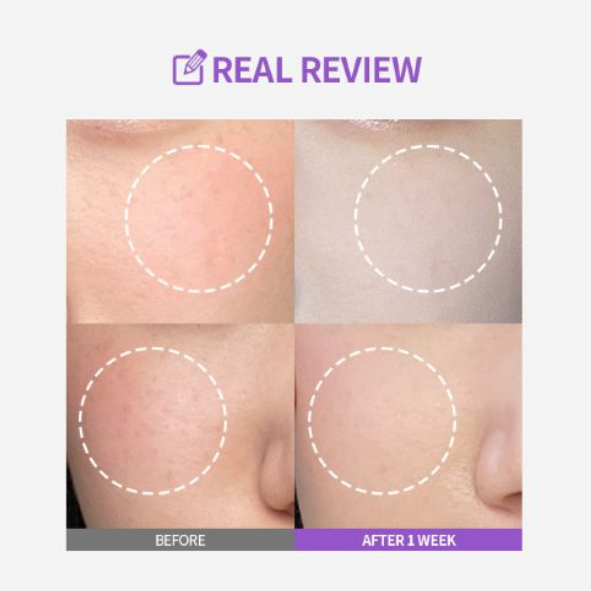 SUNGBOON EDITOR - Meoru Podo Vita C Dark Spot Ampoule 30ml
