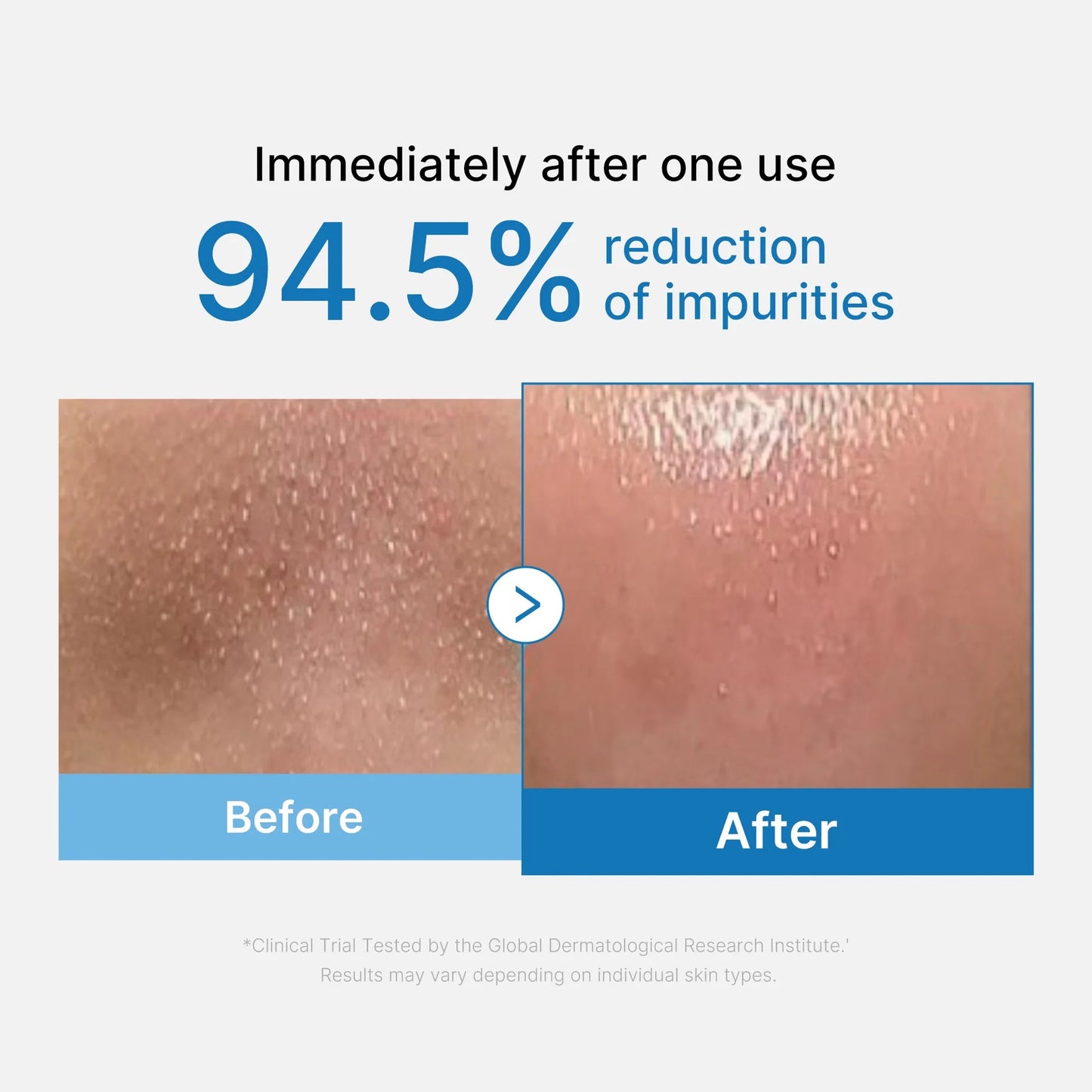 Medicube - Zero Pore Blackhead Deep Cleansing Oil 205ml