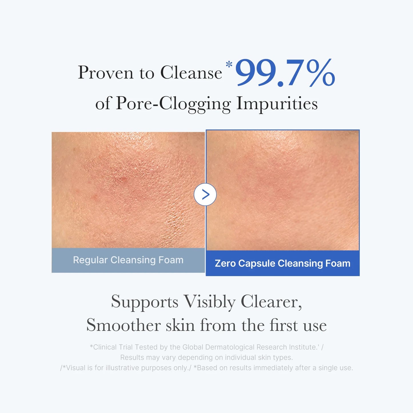 Medicube - Zero Pore SA Clear Capsule Cleansing Foam 120g