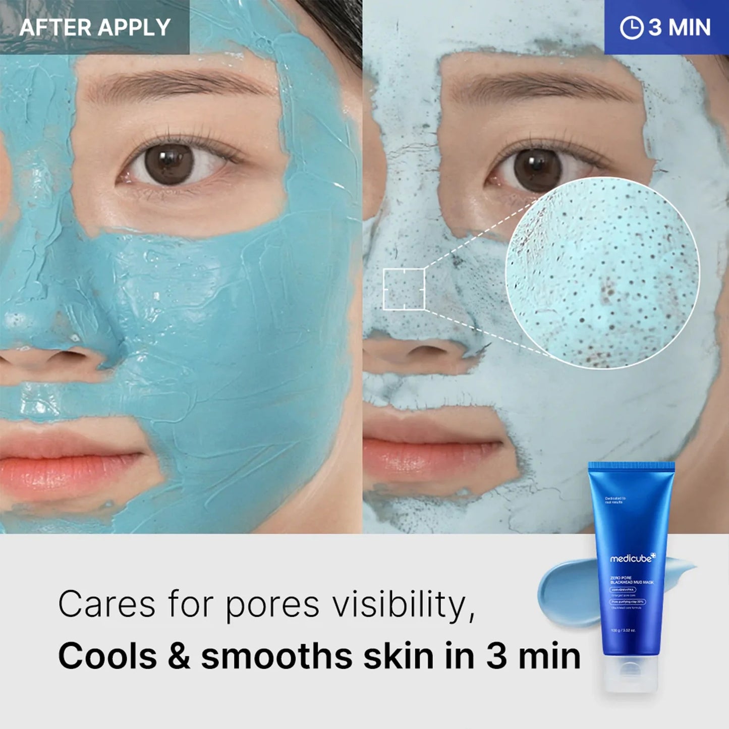Medicube - Zero pore blackhead mud mask 100g