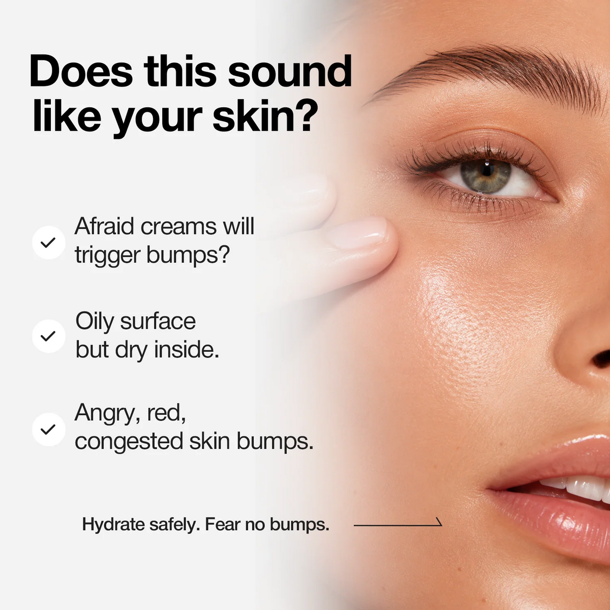 NINELESS - A-CONTROL Azelaic Acid Cream 50ml