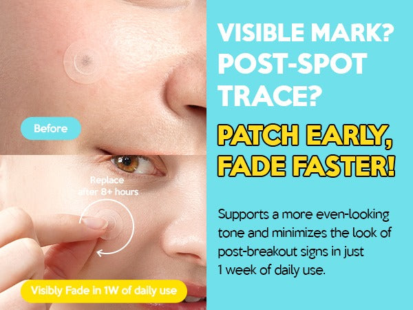 Troubless - Micro-Point Patch Plus Vitamin C 10% 9 Patches