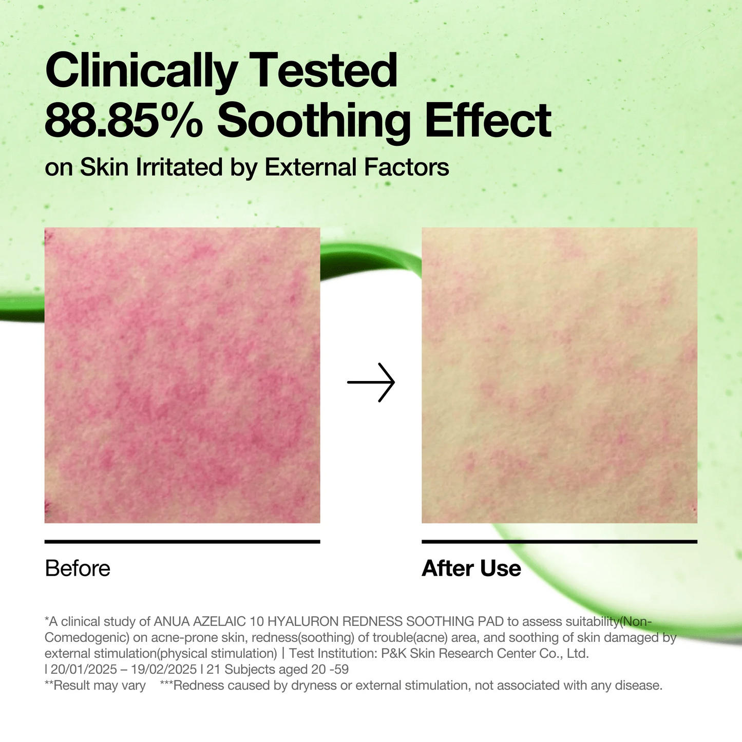 Anua - Azelaic acid 10 hyaluron redness soothing pad 230ml