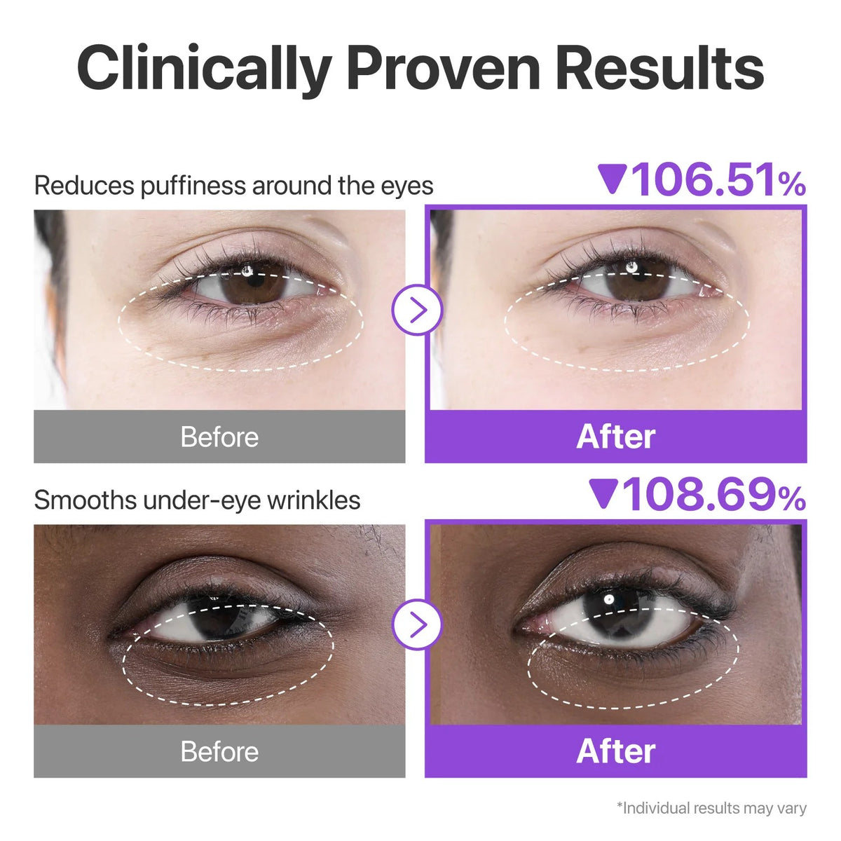 numbuzin - No.9 NAD Collagen Under Eye Patches 5ea