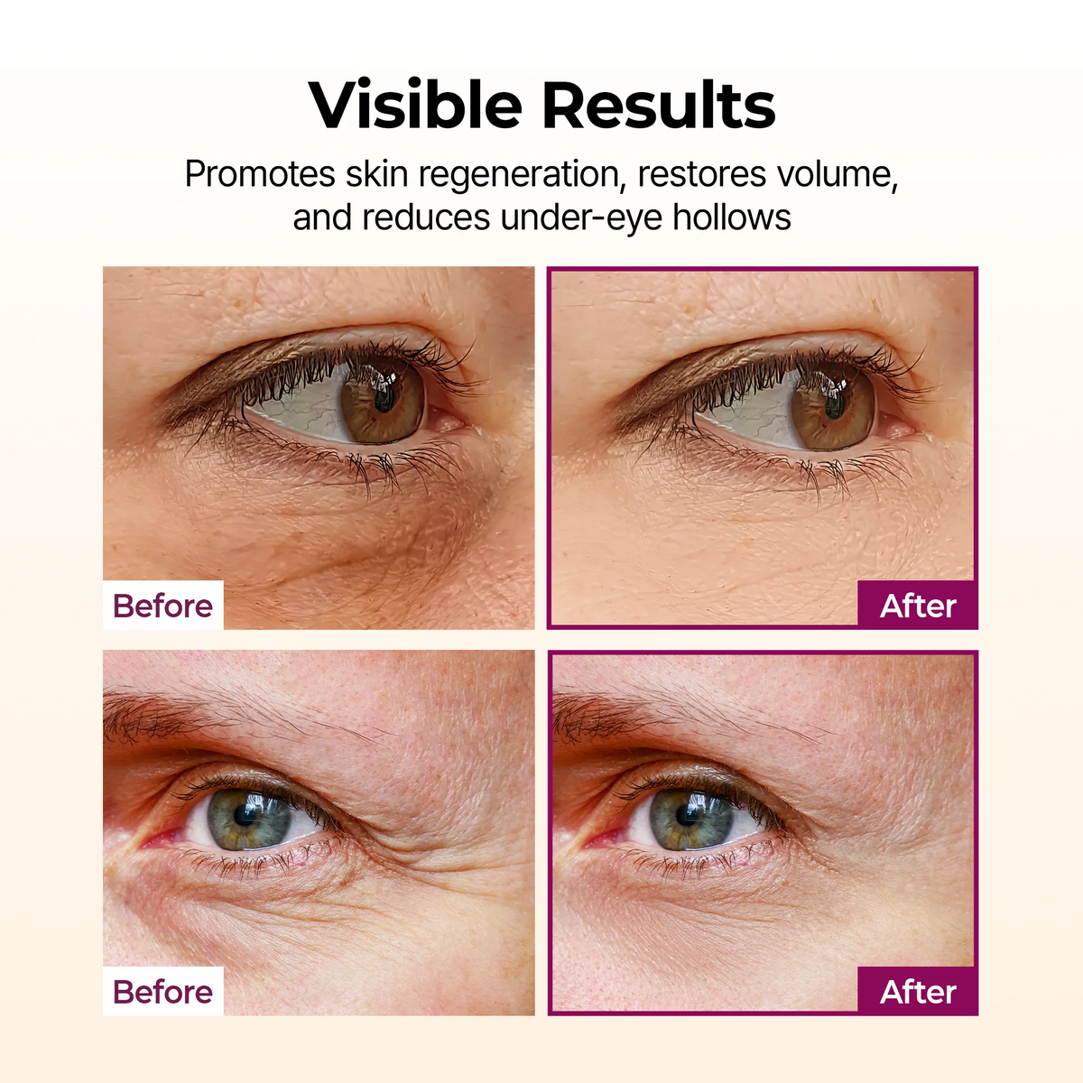 Dr.Melaxin - Cemenrete Calcium Volume Multi Balm