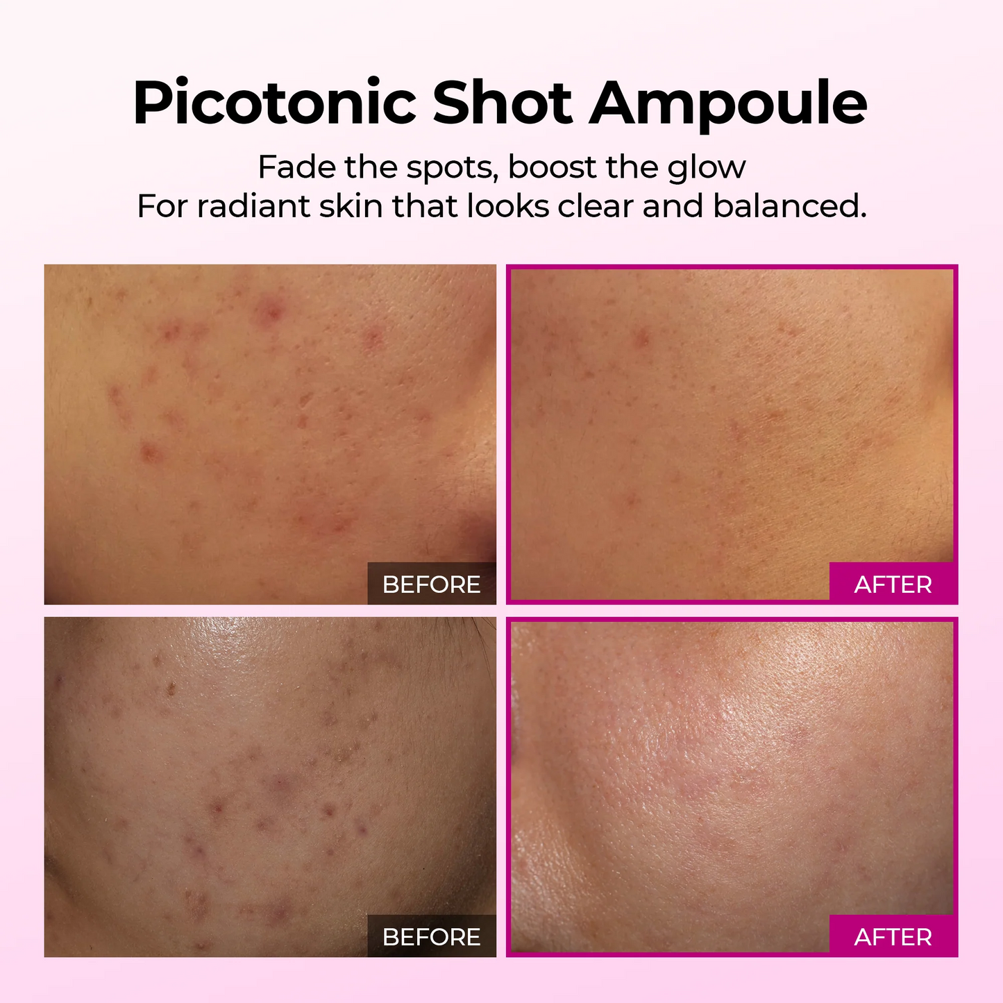 Dr.Melaxin - Picotonic Shot Pigmentation Ampoule 30ml
