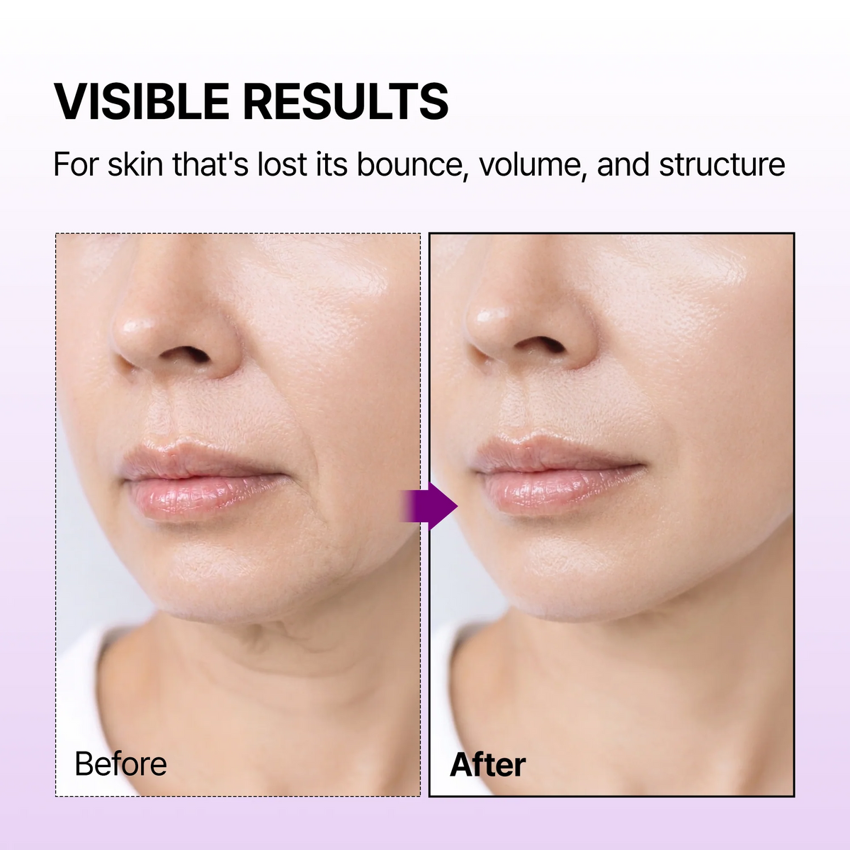 Dr.Melaxin - Calcium Bonding Facial Cream 100ml