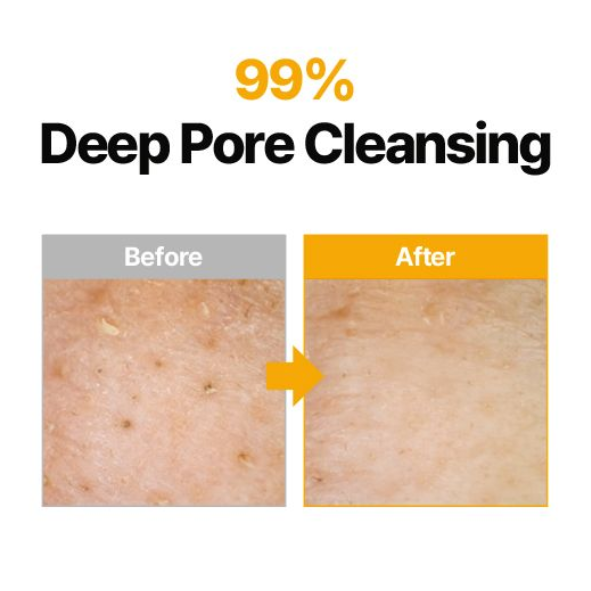 ma:nyo - Pure Cleansing Oil 200ml